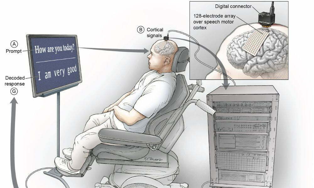 Brain_computer_interface