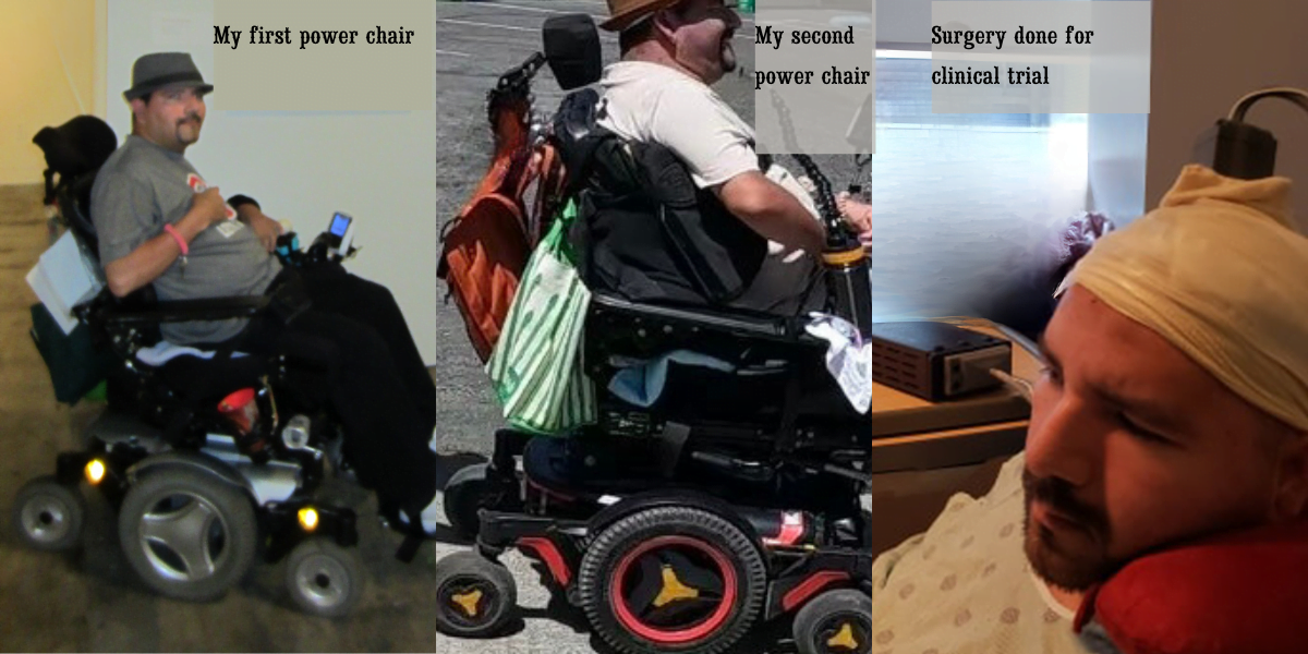 a photo showing my first power chair, my second power chair and the day of my surgery for the clinical trial